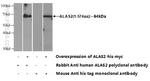 ALAS2 Antibody in Western Blot (WB)