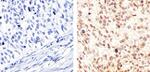 c-Myc Antibody in Immunohistochemistry (Paraffin) (IHC (P))