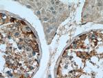 SRGAP1 Antibody in Immunohistochemistry (Paraffin) (IHC (P))