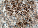 SRGAP1 Antibody in Immunohistochemistry (Paraffin) (IHC (P))
