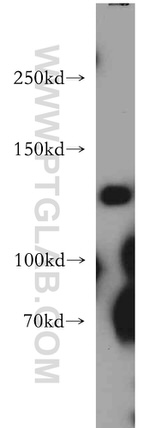 SRGAP1 Antibody in Western Blot (WB)