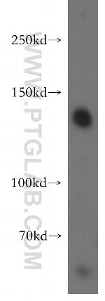 SRGAP1 Antibody in Western Blot (WB)