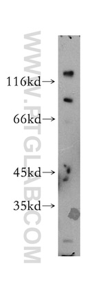 SRGAP1 Antibody in Western Blot (WB)