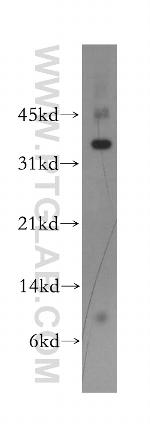 FGFBP2 Antibody in Western Blot (WB)