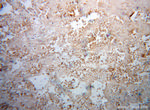 DLX3 Antibody in Immunohistochemistry (Paraffin) (IHC (P))