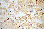 DLX3 Antibody in Immunohistochemistry (Paraffin) (IHC (P))