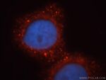 MPPED2 Antibody in Immunocytochemistry (ICC/IF)