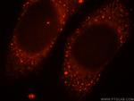 MPPED2 Antibody in Immunocytochemistry (ICC/IF)