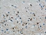 MPPED2 Antibody in Immunohistochemistry (Paraffin) (IHC (P))