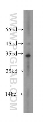 MPPED2 Antibody in Western Blot (WB)