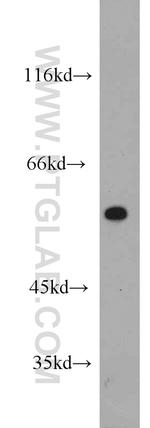 CPEB1 Antibody in Western Blot (WB)