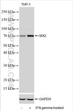 MX2 Antibody in Western Blot (WB)