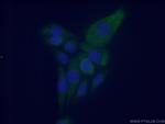 Fibromodulin Antibody in Immunocytochemistry (ICC/IF)