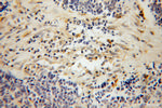 PARVG Antibody in Immunohistochemistry (Paraffin) (IHC (P))