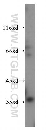 PARVG Antibody in Western Blot (WB)