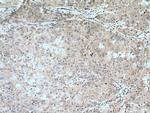 ZBP1 Antibody in Immunohistochemistry (Paraffin) (IHC (P))
