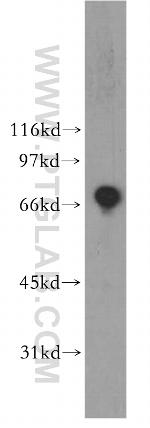 ZBP1 Antibody in Western Blot (WB)