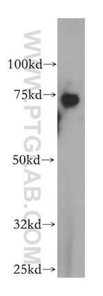 ZBP1 Antibody in Western Blot (WB)