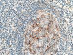 IL12RB1 Antibody in Immunohistochemistry (Paraffin) (IHC (P))