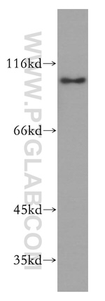 SNX25 Antibody in Western Blot (WB)