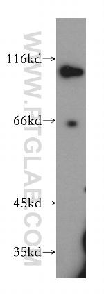 SNX25 Antibody in Western Blot (WB)