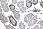 Cyclin A1 Antibody in Immunohistochemistry (Paraffin) (IHC (P))