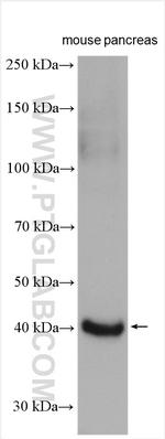 SERPINI2 Antibody in Western Blot (WB)