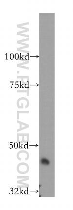 SERPINI2 Antibody in Western Blot (WB)