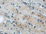 BNP Antibody in Immunohistochemistry (Paraffin) (IHC (P))
