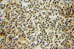 Syntaxin 11 Antibody in Immunohistochemistry (Paraffin) (IHC (P))