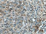 Syntaxin 11 Antibody in Immunohistochemistry (Paraffin) (IHC (P))