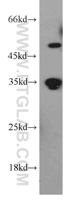 Syntaxin 11 Antibody in Western Blot (WB)