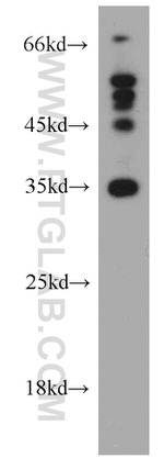 Syntaxin 11 Antibody in Western Blot (WB)