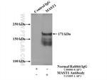 MAST1 Antibody in Immunoprecipitation (IP)