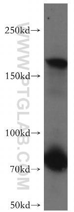 MAST1 Antibody in Western Blot (WB)
