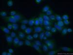 ATP2C1 Antibody in Immunocytochemistry (ICC/IF)
