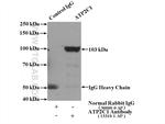 ATP2C1 Antibody in Immunoprecipitation (IP)