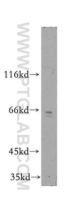 TRAM2 Antibody in Western Blot (WB)