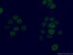 GMEB2 Antibody in Immunocytochemistry (ICC/IF)