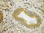 GMEB2 Antibody in Immunohistochemistry (Paraffin) (IHC (P))
