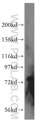 GMEB2 Antibody in Western Blot (WB)