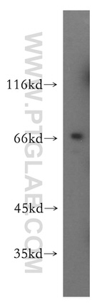 GMEB2 Antibody in Western Blot (WB)