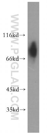 GMEB2 Antibody in Western Blot (WB)