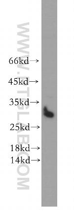 STOML3 Antibody in Western Blot (WB)