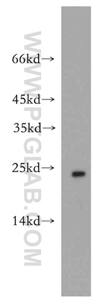 Cytoglobin Antibody in Western Blot (WB)