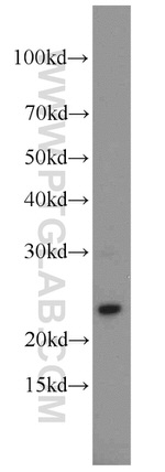 Cytoglobin Antibody in Western Blot (WB)