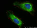 CSDE1 Antibody in Immunocytochemistry (ICC/IF)