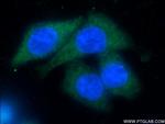 CSDE1 Antibody in Immunocytochemistry (ICC/IF)