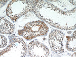 CSDE1 Antibody in Immunohistochemistry (Paraffin) (IHC (P))