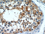 CSDE1 Antibody in Immunohistochemistry (Paraffin) (IHC (P))